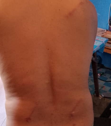 Social Residents Attack